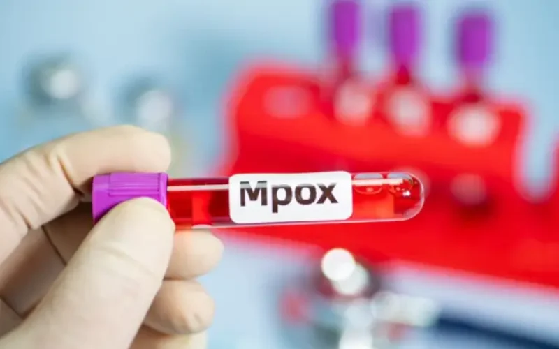 Mpox: Governo do Estado esclarece que não há casos suspeitos, prováveis ou confirmados no Amapá em 2025